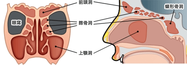副鼻腔
