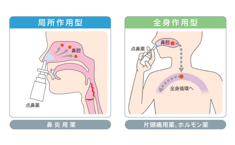 なぜ効く？点鼻薬 鼻づまりの原因と点鼻薬